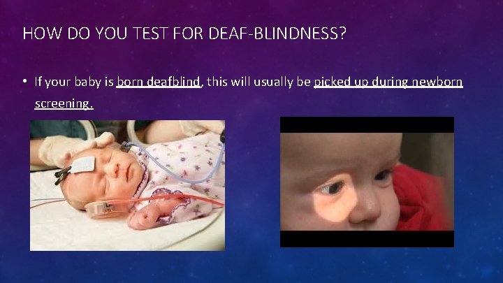 HOW DO YOU TEST FOR DEAF-BLINDNESS? • If your baby is born deafblind, this