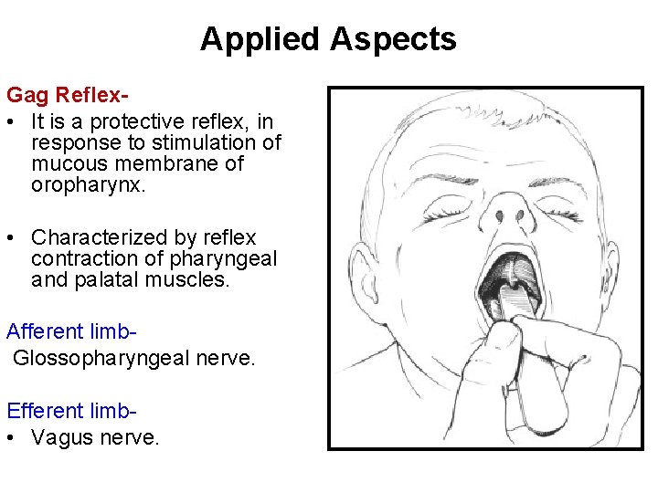 Applied Aspects Gag Reflex • It is a protective reflex, in response to stimulation
