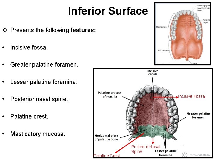 Inferior Surface v Presents the following features: • Incisive fossa. • Greater palatine foramen.