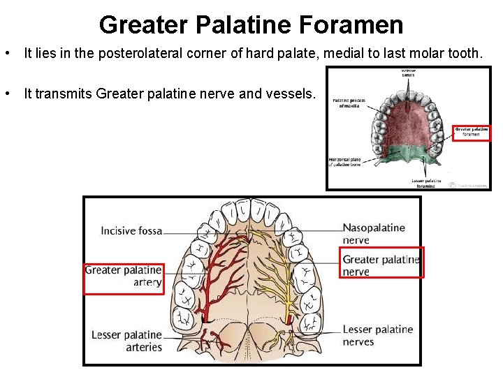 Greater Palatine Foramen • It lies in the posterolateral corner of hard palate, medial