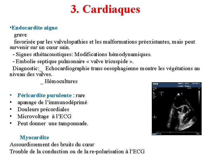 3. Cardiaques • Endocardite aigue grave favorisée par les valvulopathies et les malformations préexistantes,