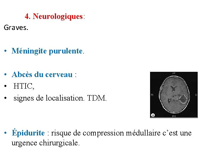 4. Neurologiques: Graves. • Méningite purulente. • Abcès du cerveau : • HTIC, •