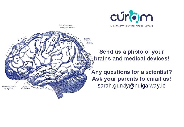Send us a photo of your brains and medical devices! Any questions for a