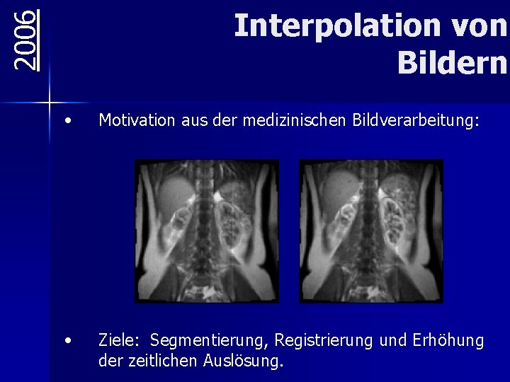 2006 Interpolation von Bildern • Motivation aus der medizinischen Bildverarbeitung: • Ziele: Segmentierung, Registrierung