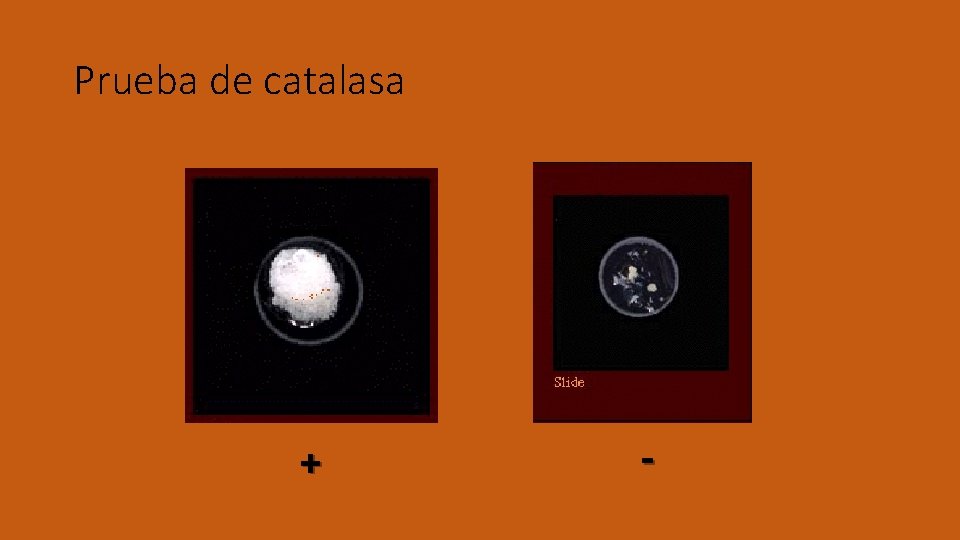 Prueba de catalasa + - 