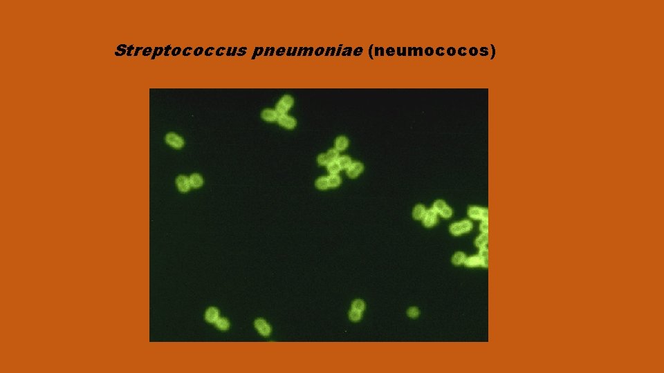 Streptococcus pneumoniae (neumococos) 