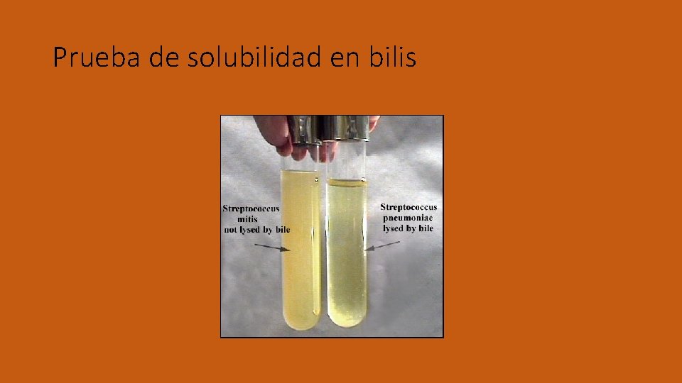 Prueba de solubilidad en bilis 