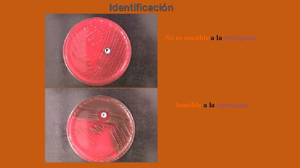 Identificación No es sensible a la optoquina Sensible a la optoquina 