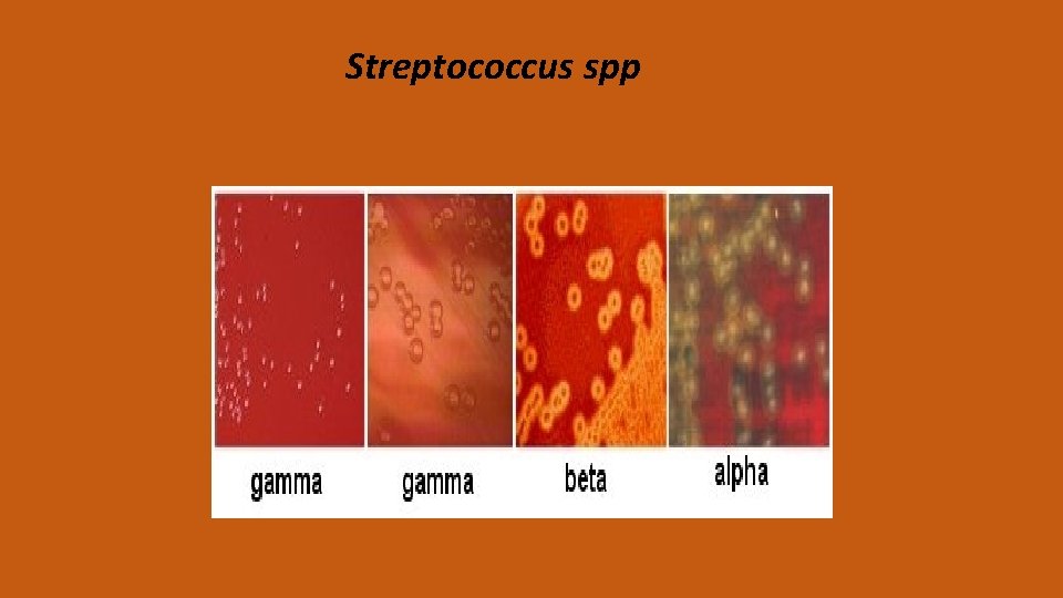 Streptococcus spp 