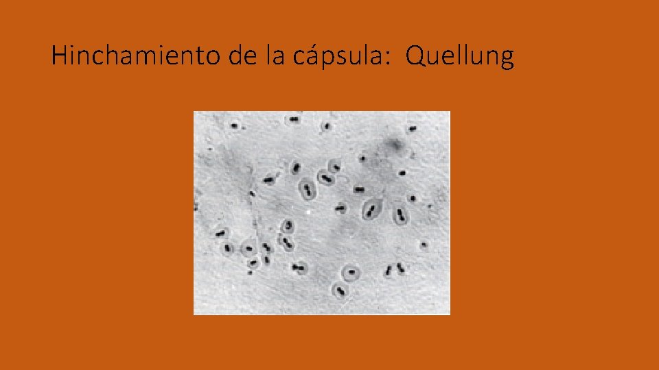 Hinchamiento de la cápsula: Quellung 