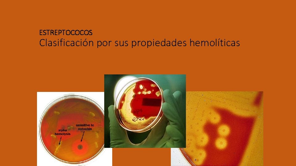 ESTREPTOCOCOS Clasificación por sus propiedades hemolíticas 