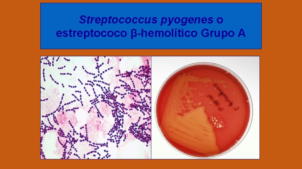 Streptococcus pyogenes o estreptococo β-hemolítico Grupo A 