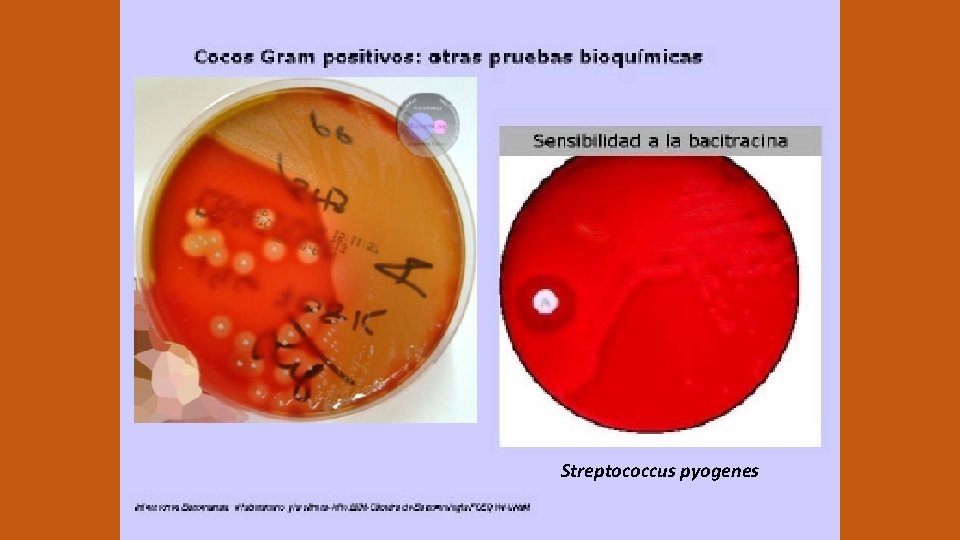 Streptococcus pyogenes 
