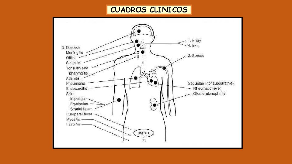 CUADROS CLINICOS 