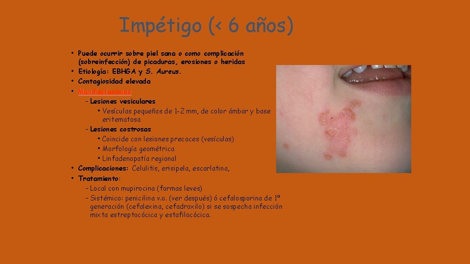 Impétigo (< 6 años) • Puede ocurrir sobre piel sana o complicación (sobreinfección) de