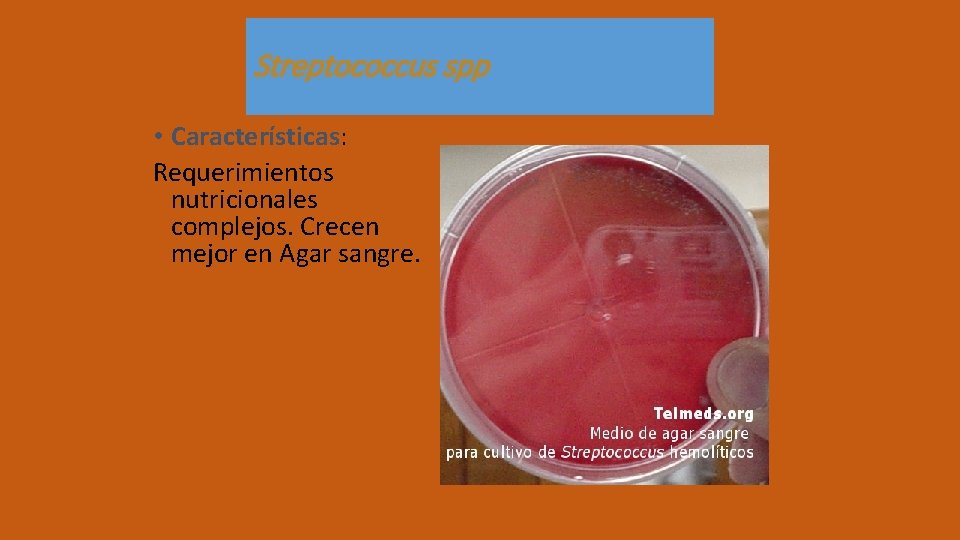 Streptococcus spp • Características: Requerimientos nutricionales complejos. Crecen mejor en Agar sangre. 