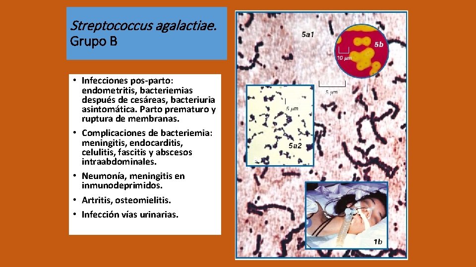 Streptococcus agalactiae. Grupo B • Infecciones pos-parto: endometritis, bacteriemias después de cesáreas, bacteriuria asintomática.