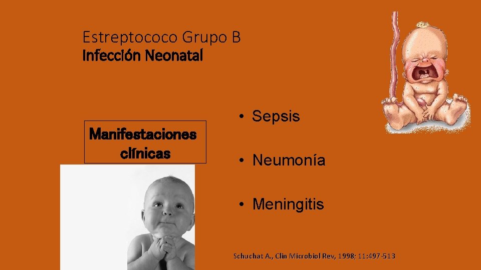 Estreptococo Grupo B Infección Neonatal • Sepsis Manifestaciones clínicas • Neumonía • Meningitis Schuchat