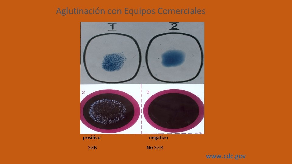 Aglutinación con Equipos Comerciales positivo SGB negativo No SGB www. cdc. gov 