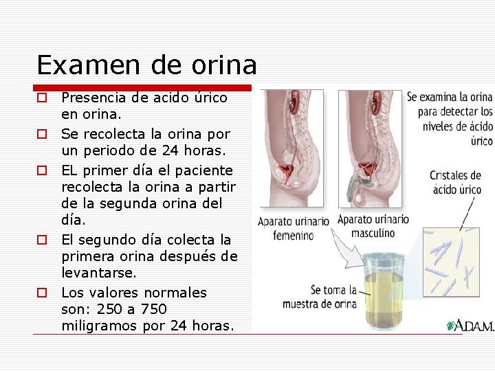 Examen de orina o Presencia de acido úrico en orina. o Se recolecta la