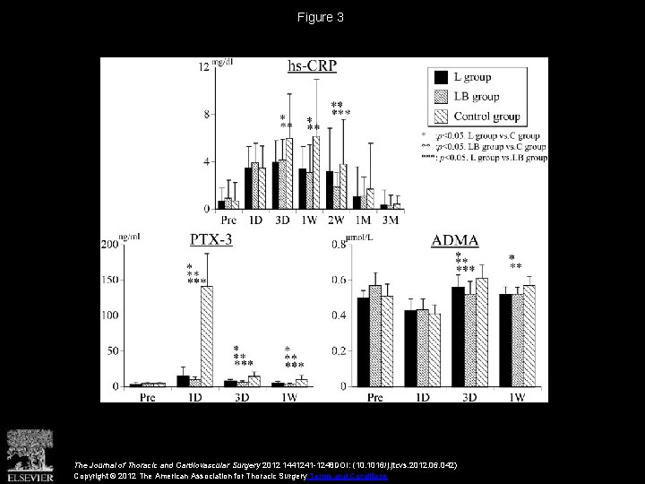 Feasibility of landiolol and bisoprolol for prevention of