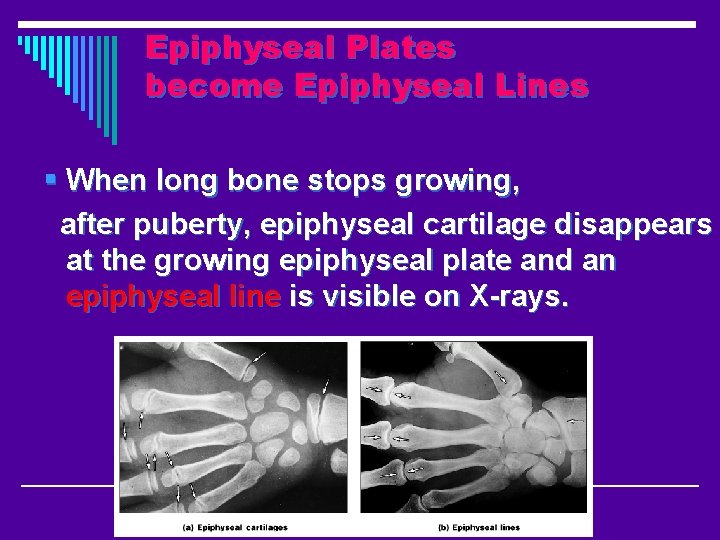 Epiphyseal Plates become Epiphyseal Lines § When long bone stops growing, after puberty, epiphyseal