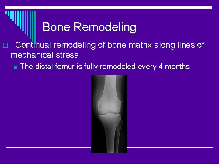 Bone Remodeling o Continual remodeling of bone matrix along lines of mechanical stress n