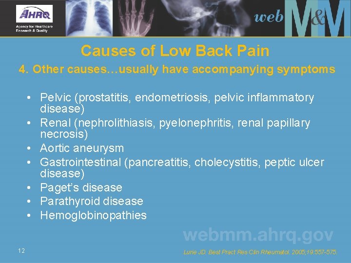 Causes of Low Back Pain 4. Other causes…usually have accompanying symptoms • Pelvic (prostatitis,