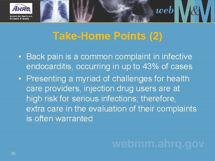 Take-Home Points (2) • Back pain is a common complaint in infective endocarditis, occurring