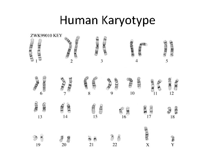 Human Karyotype 