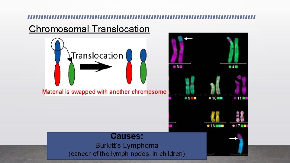 Chromosomal Translocation Material is swapped with another chromosome Causes: Burkitt’s Lymphoma (cancer of the