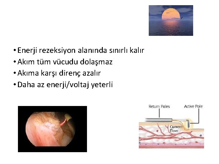  • Enerji rezeksiyon alanında sınırlı kalır • Akım tüm vücudu dolaşmaz • Akıma