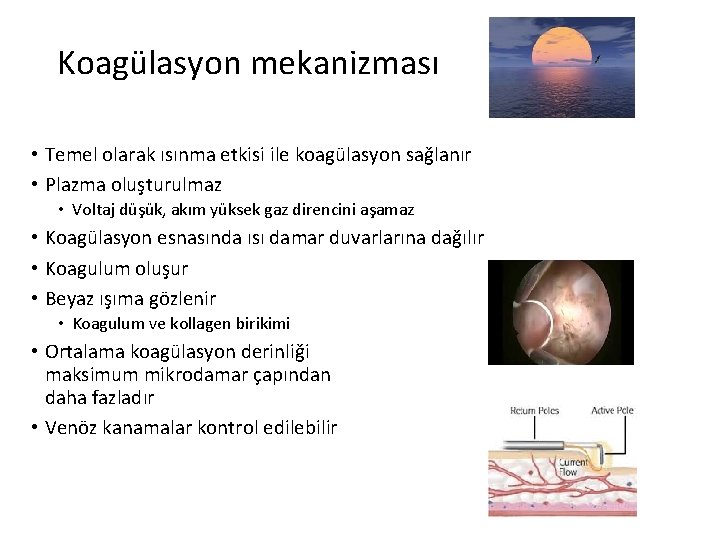 Koagülasyon mekanizması • Temel olarak ısınma etkisi ile koagülasyon sağlanır • Plazma oluşturulmaz •