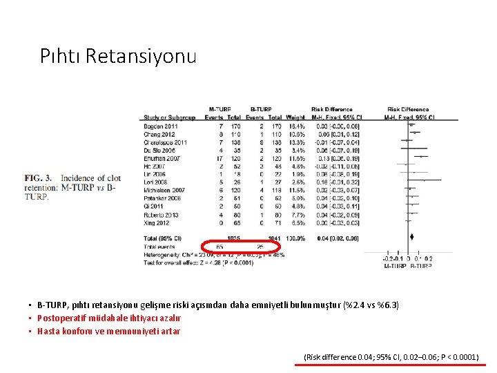Pıhtı Retansiyonu • B-TURP, pıhtı retansiyonu gelişme riski açısından daha emniyetli bulunmuştur (%2. 4