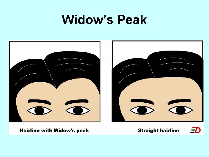 Widow’s Peak 