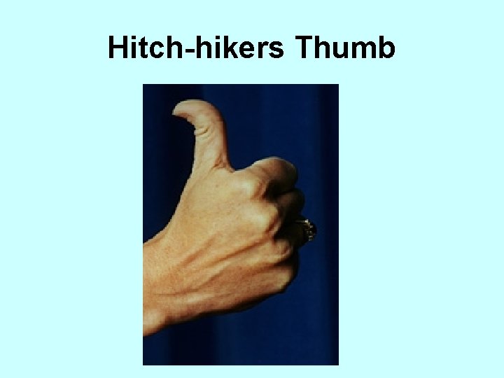 Hitch-hikers Thumb 