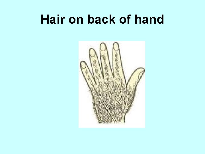 Hair on back of hand 