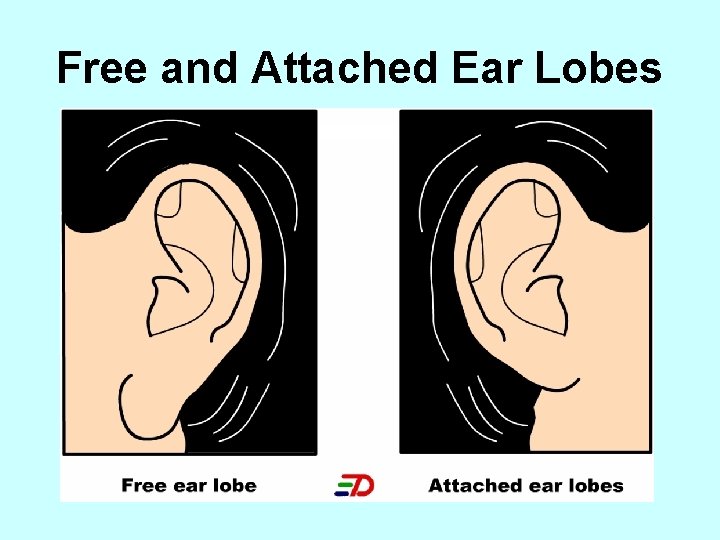 Free and Attached Ear Lobes 