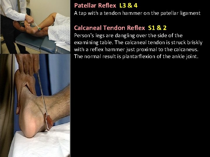 Patellar Reflex L 3 & 4 A tap with a tendon hammer on the
