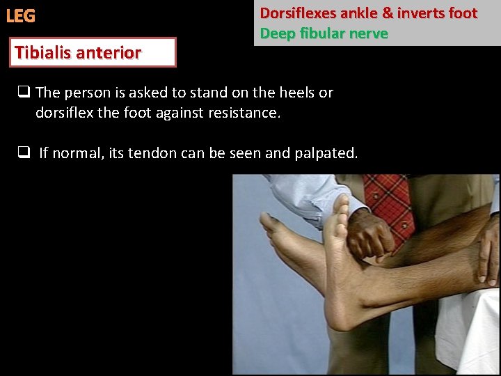 LEG Tibialis anterior Dorsiflexes ankle & inverts foot Deep fibular nerve q The person