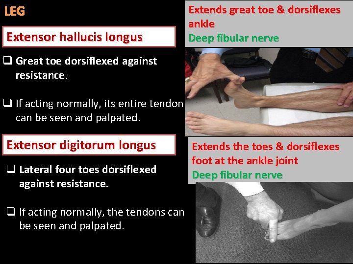 LEG Extensor hallucis longus Extends great toe & dorsiflexes ankle Deep fibular nerve q