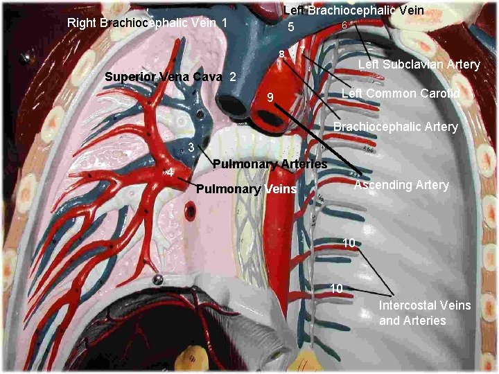 Left Brachiocephalic Vein 6 5 Right Brachiocephalic Vein 1 8 7 Left Subclavian Artery