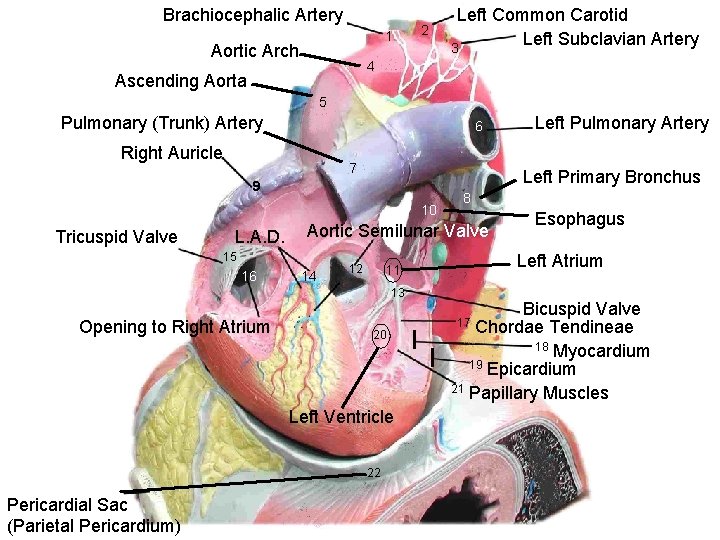 Brachiocephalic Artery 1 Aortic Arch 2 Left Common Carotid Left Subclavian Artery 3 4