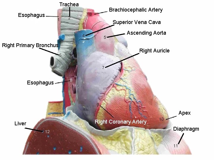 Trachea Esophagus 1 Brachiocephalic Artery 3 2 Superior Vena Cava 4 5 Right Primary