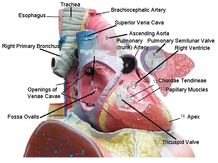 Trachea Esophagus 1 3 2 Superior Vena Cava 4 Right Primary Bronchus 6 Brachiocephalic