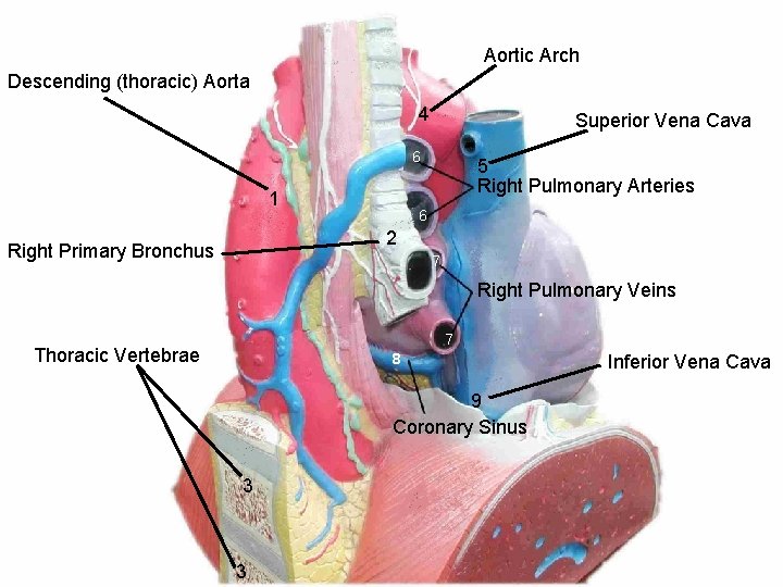 Aortic Arch Descending (thoracic) Aorta 4 Superior Vena Cava 6 1 5 Right Pulmonary