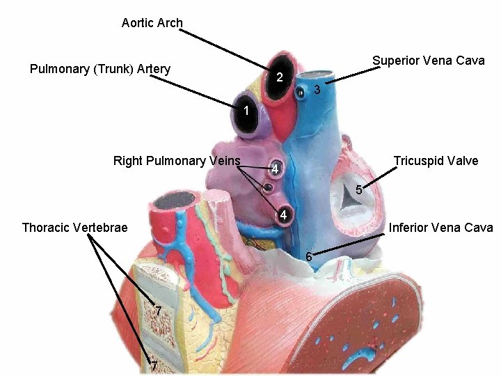 Aortic Arch Superior Vena Cava Pulmonary (Trunk) Artery 2 3 1 Right Pulmonary Veins