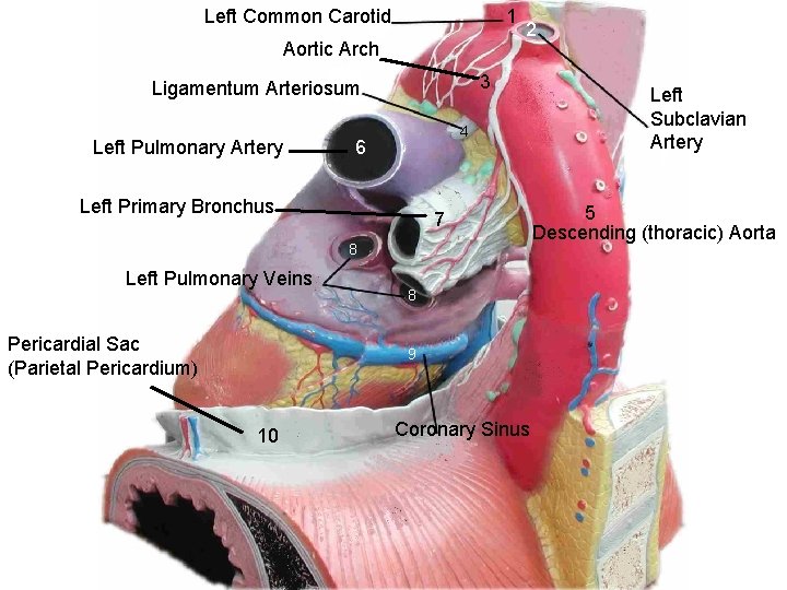 Left Common Carotid 1 Aortic Arch 3 Ligamentum Arteriosum Left Pulmonary Artery 2 4