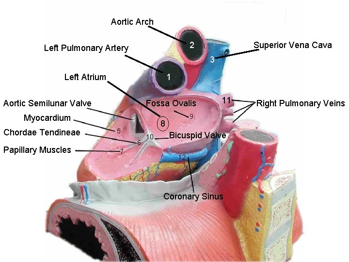Aortic Arch 2 Left Pulmonary Artery Superior Vena Cava 3 Left Atrium 1 Aortic