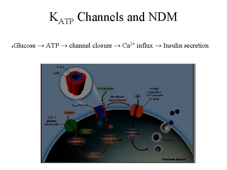 KATP Channels and NDM ● Glucose → ATP → channel closure → Ca 2+